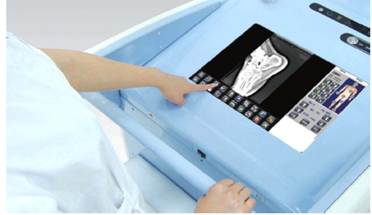 Portable Digital X-Ray System
