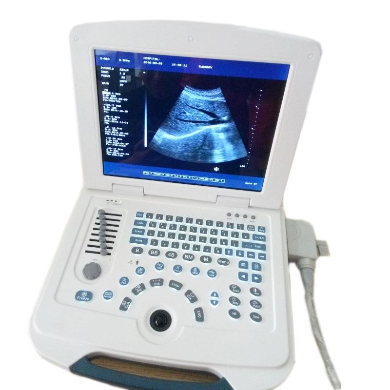 Portable Ultrasound Machine Portable Ultrasound Machine