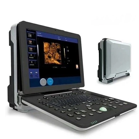 Professional cardiac color ultrasound equipment Professional cardiac color ultrasound equipment