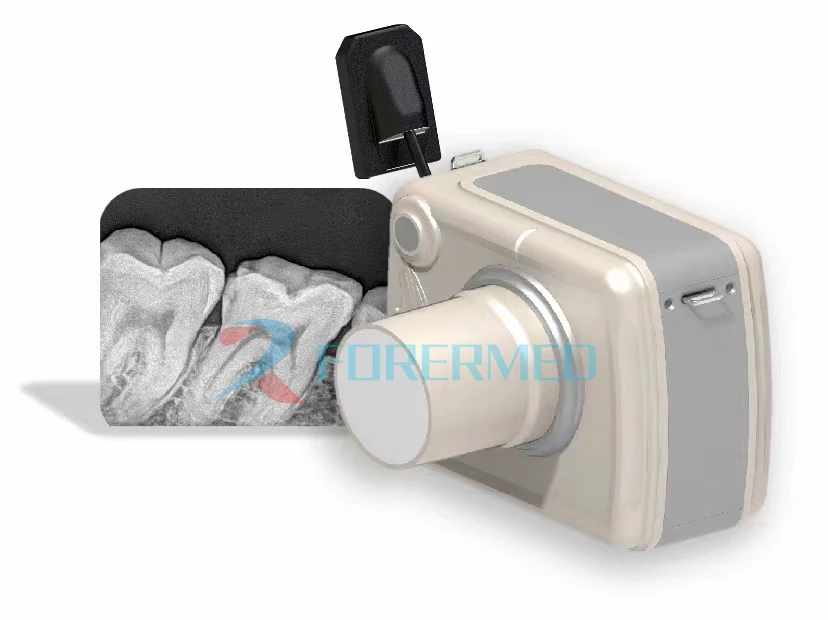 sensor dental x-ray sensor dental x-ray