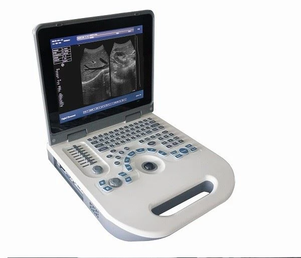 Full Digital Ultrasound Scan Machines