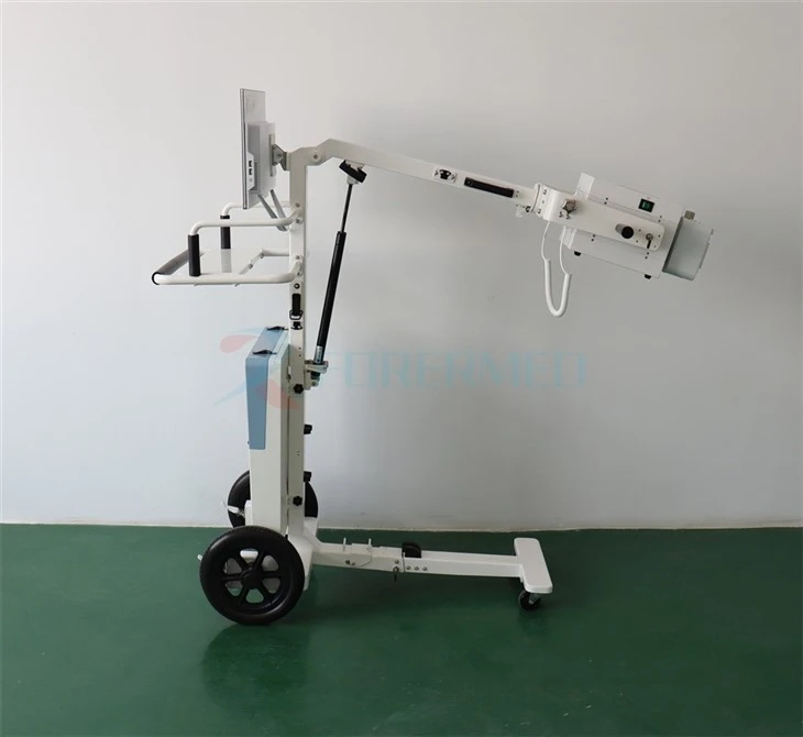 Mobile Digital X Ray Machine Mobile Digital X Ray Machine
