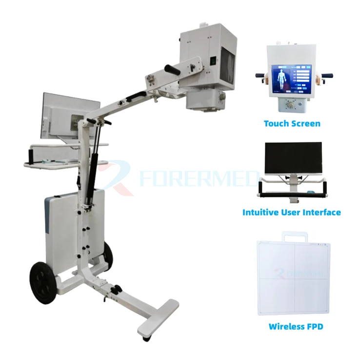 Mobile Digital X Ray Machine Mobile Digital X Ray Machine